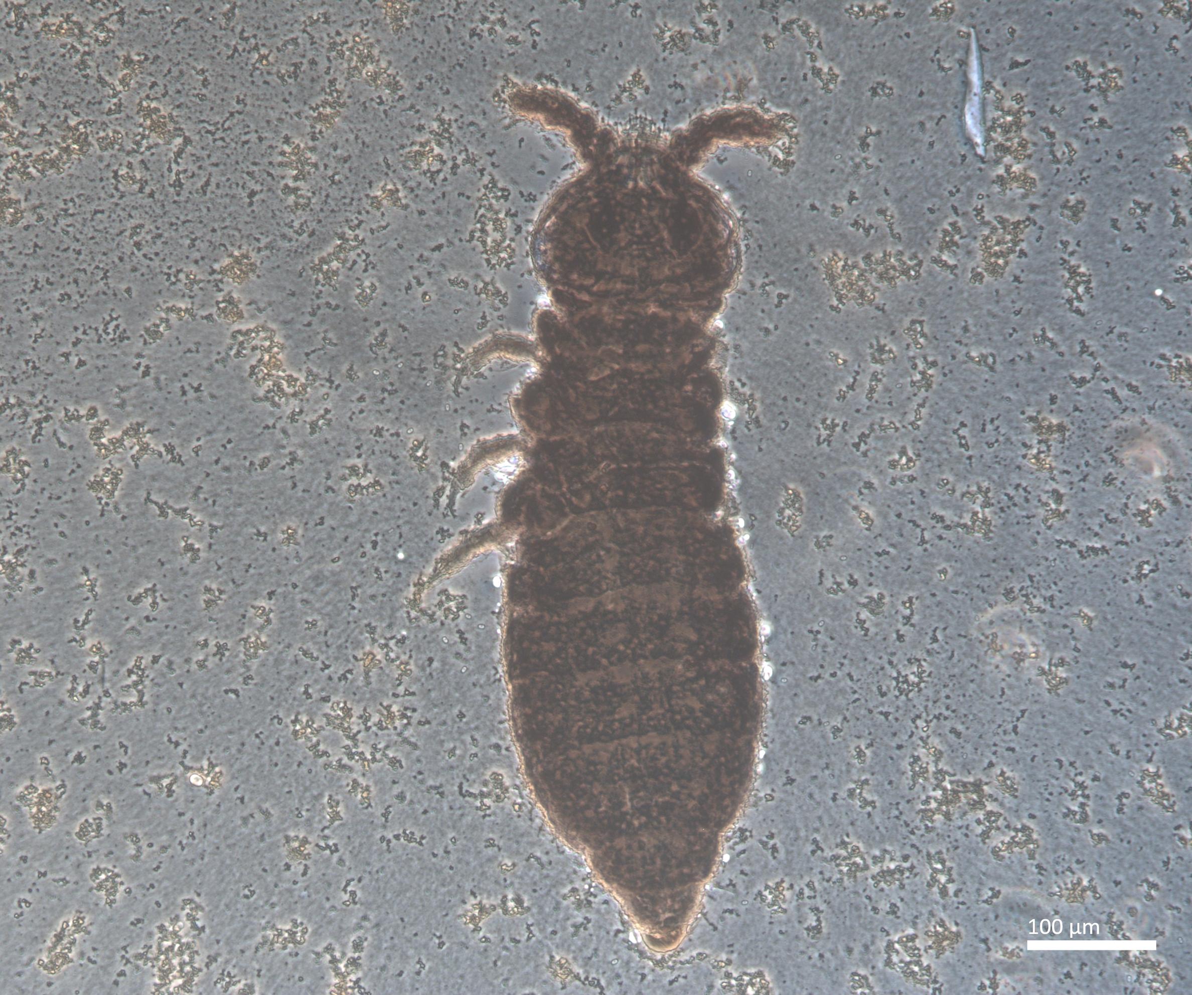 Slide preparation of Xenylla yucatana, housed in the ICCDRS collection (ICCDRS 27098). Photo: Marc Barreda, CDF, 2024.
